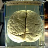 Em busca da melhor versão 🧠